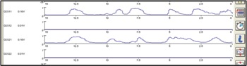 figures 1 and 1a: pre- and post-oxygen sensors under normal activity.